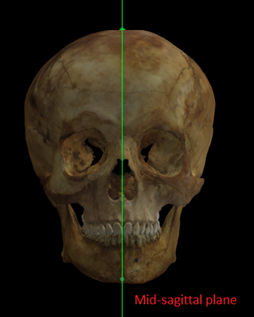 Mid-saggital plane