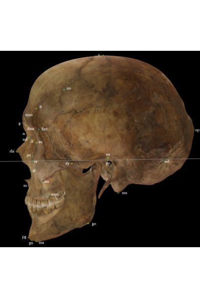 Craniometric landmarks on a skull 3D model lateral position